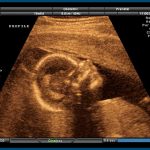 thumbnail of A Democratic Governor for Life?