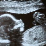thumbnail of When Abortion Gets Even More Sinister